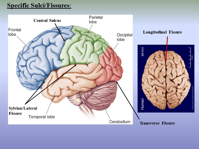 Longitudinal Fissure Transverse Fissure Sylvian/Lateral Fissure Central Sulcus Specific Sulci/Fissures: